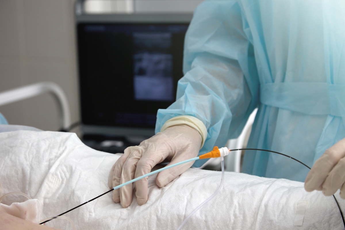 Remimazolam Versus Propofol in Catheter Ablation